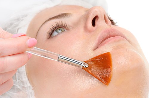 Chemical peel -treatment